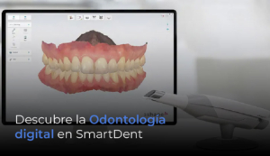 Scanner 3d